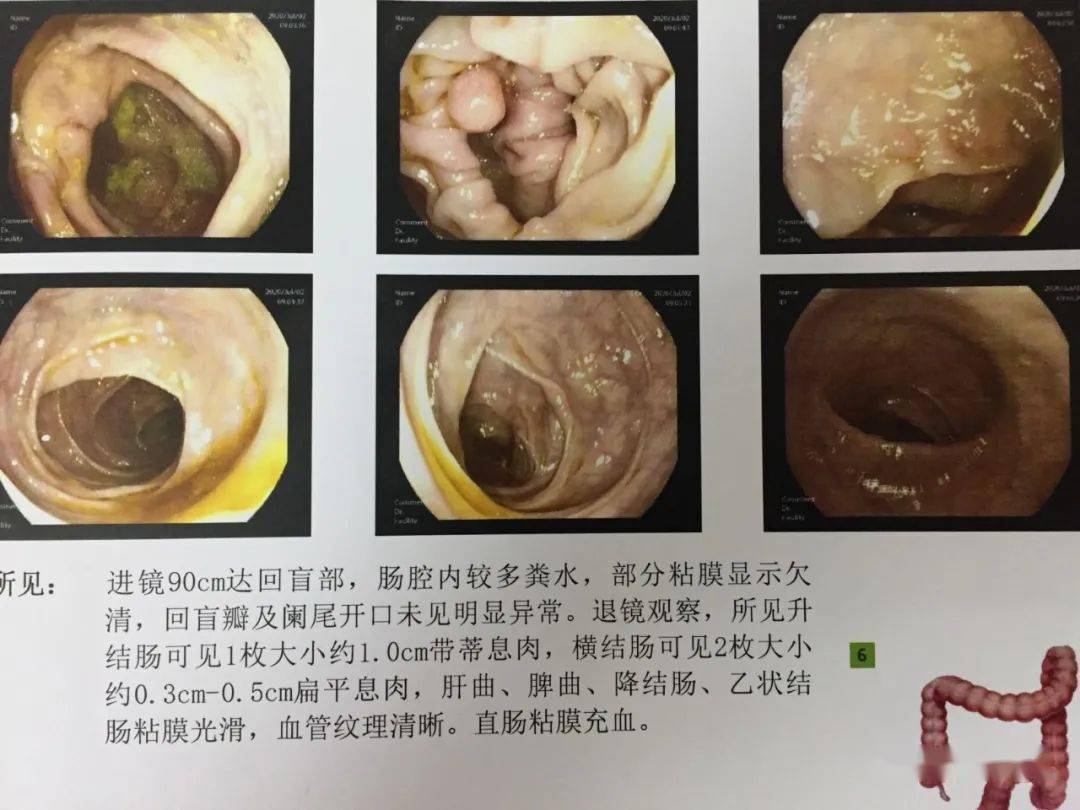 最新术前禁食禁水时间研究及其应用实践